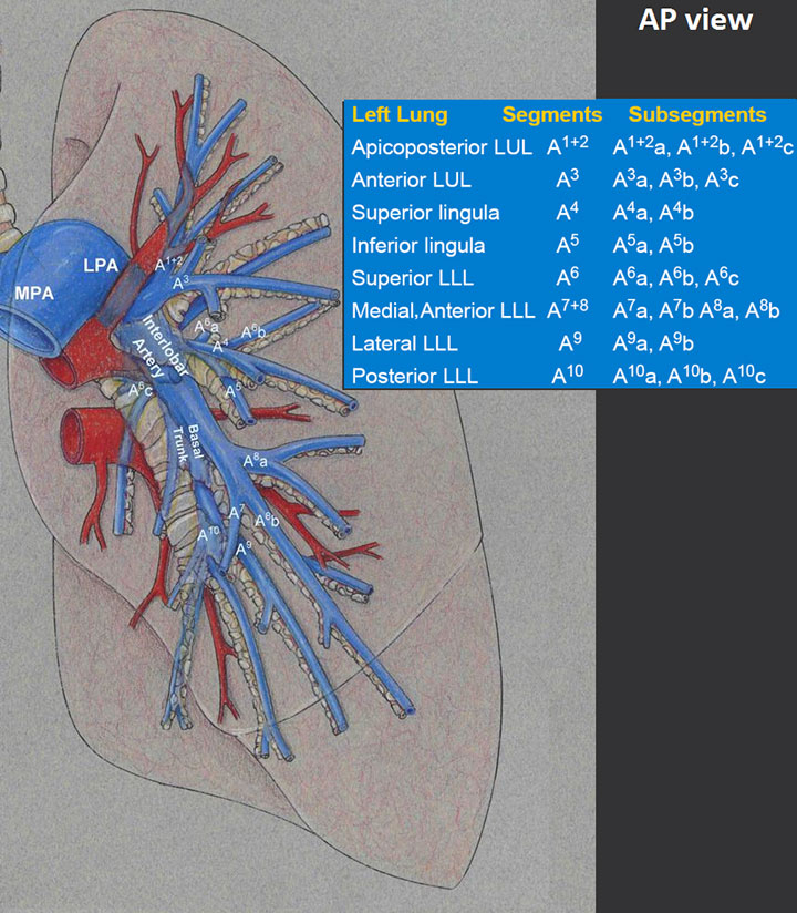 CT Pulmonary Angiography